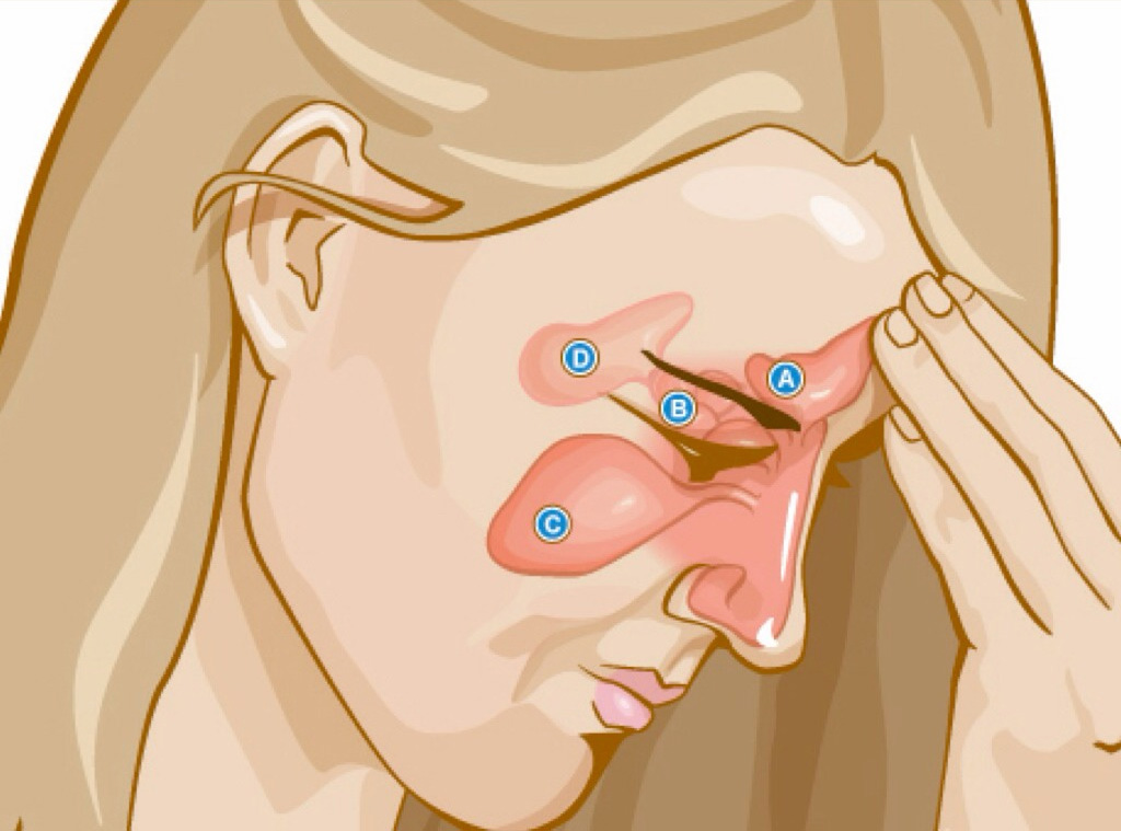 Неприятный запах изо рта: физиология или болезнь?