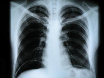 Где пройти рентген грудной клетки в Зеленограде