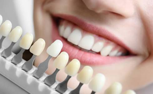 Обретение идеальной улыбки в центре эстетической стоматологии в Зеленограде