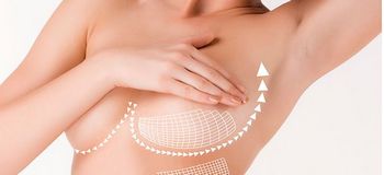 Схема подтяжки груди