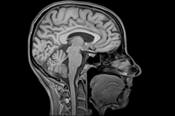 Как выглядит МРТ головы в Зеленограде