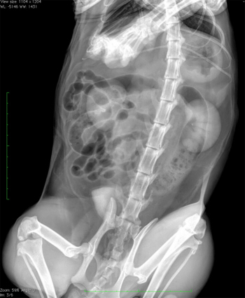 Проведение рентгена брюшной полости в КДЦ 24