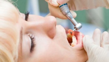Как происходит процедура сепарации зуба