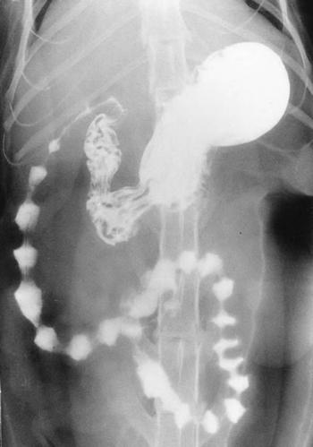 Как выглядит рентген брюшной полости в Зеленограде